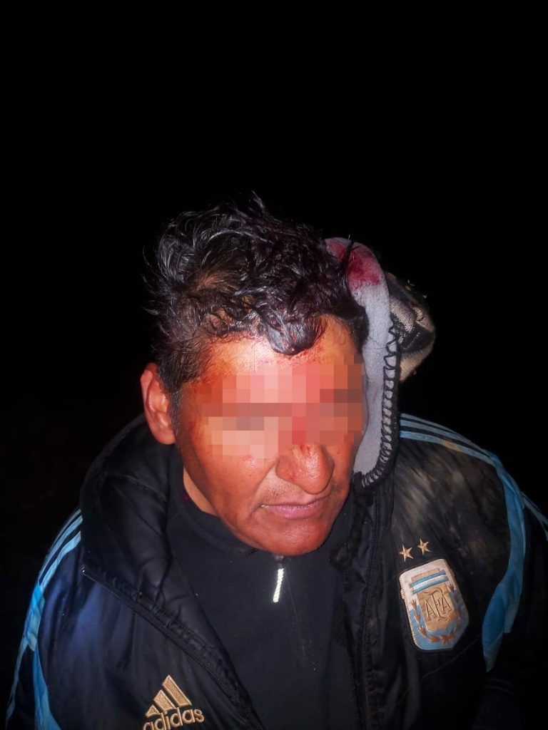 Reportan heridos en Cocapata luego de un ataque de avasalladores.